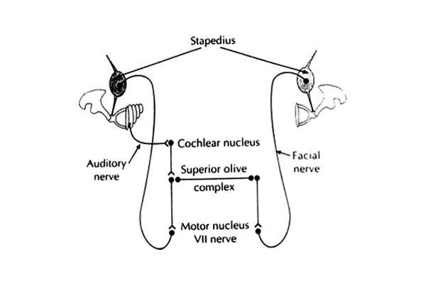 Reflex Audiometry