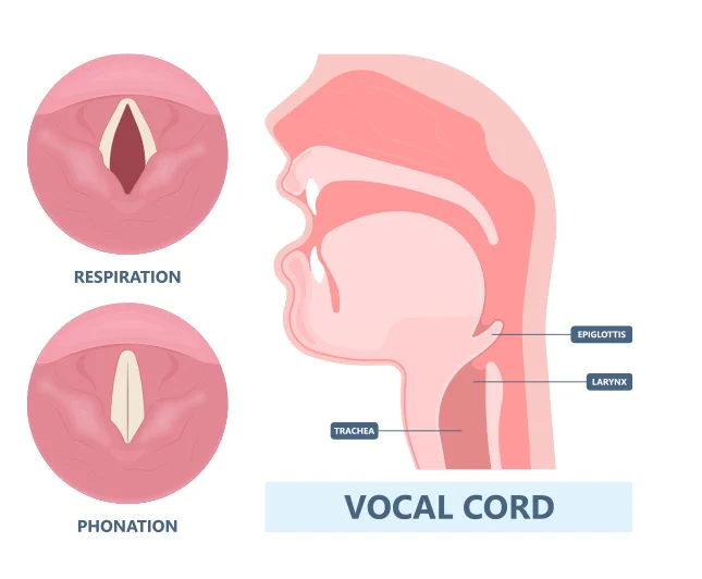 Voice Therapy for Vocal Cord Paralysis